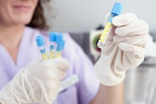 Complications of a Low Platelet Count