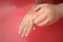 Red Skin Blotches on the Hand