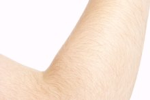 Elbow Hyperextended Treatment