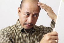 Greasy & Thinning Hair
