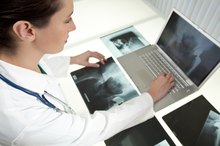 Most Common Side Effects After Hip Replacement Surgery
