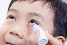 Causes of White Eye Discharge
