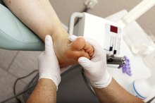Do Podiatrists Remove Corns?