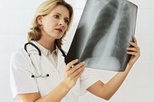 Causes of Shortness of Breath When Lying Down