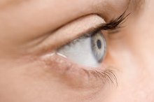 Diet & Thin Corneas
