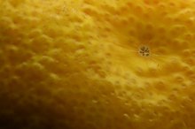 Lemons & Pancreatitis