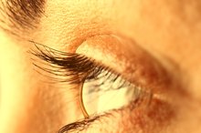 How to Get Rid of Yellow Upper Eyelids