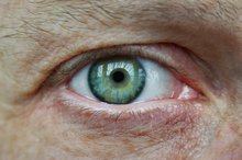 Eye Floaters and Excess Protein