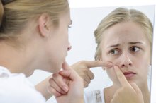 How to Get Rid of Old Acne Bumps