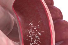 What Are the Different Types of Roundworms?