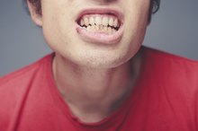 Vaseline Lip Therapy on a Cold Sore