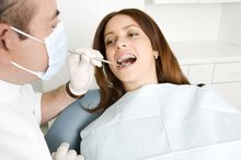 Allergies to Tooth Fillings