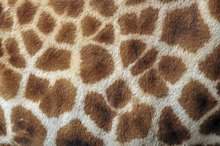What Do Scabies Look Like on Human Skin?