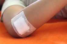 Types of Exudate From Wounds
