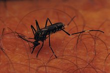 How to Dry Up Insect Bites