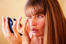 Can You Exercise Away Dark Circles Under the Eyes?