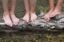 Flat Feet in Teenagers