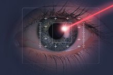 Success & Drawbacks of Laser Therapy for Neuropathy & Surgery