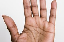 Names of Tactile Disorders