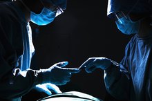 Signs of Mild Stroke After Surgery