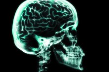 Parts of the Brain That Control Primitive Reflexes