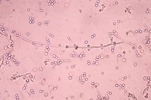Candida Side Effects