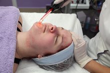 How to Get Rid of Scars From Impetigo