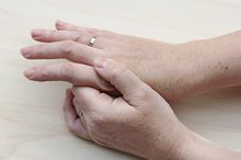 What Is Causing the Dry, Scaling Skin on My Hands?