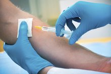 Signs of a Positive TB Test