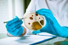 What Is the Difference Between Good Bacteria & Bad Bacteria?