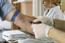 Can You Tell If You Have High Cholesterol by an Eye Exam?