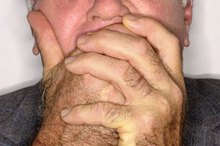 Does Vitamin B Complex Cause Bad Breath?