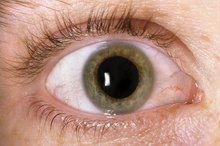 Side Effects of Over Using Red Eye Drops