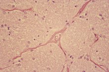 Calcium and the Optic Nerve