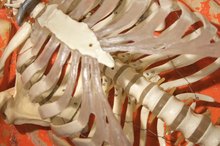 Arm Exercises With Sternal Precautions