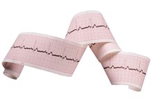Heart Arrhythmia: Iodine or Magnesium?