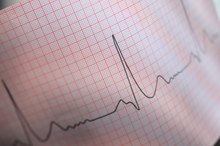 Are There Side Effects When You Stop Taking Metoprolol?