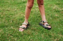 Foot and Leg Discoloration