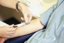 Venipuncture Methods