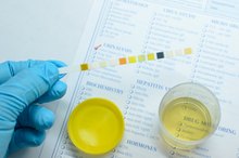 A Diagnosis of an Infection of the Urinary Tract & Lactobacillus
