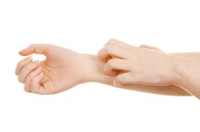 Skin Rashes & Zinc