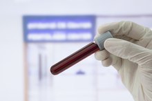 Causes of Low HCT and HGB