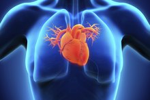 Exercising With Patent Foramen Ovale