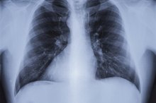 Drugs Used in Nebulizers