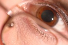 Dilated Eyes When Exercising