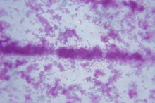 What Is the Chain of Infection for Tuberculosis?
