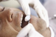 Amoxicillin for Tooth Pain