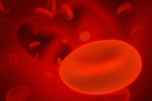 Anemia and Vitamin D Deficiency