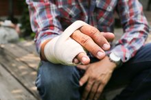 Vitamins That Help Broken Bones
