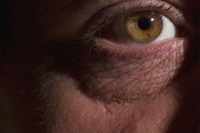 Problems After Retinal Holes Laser Surgery